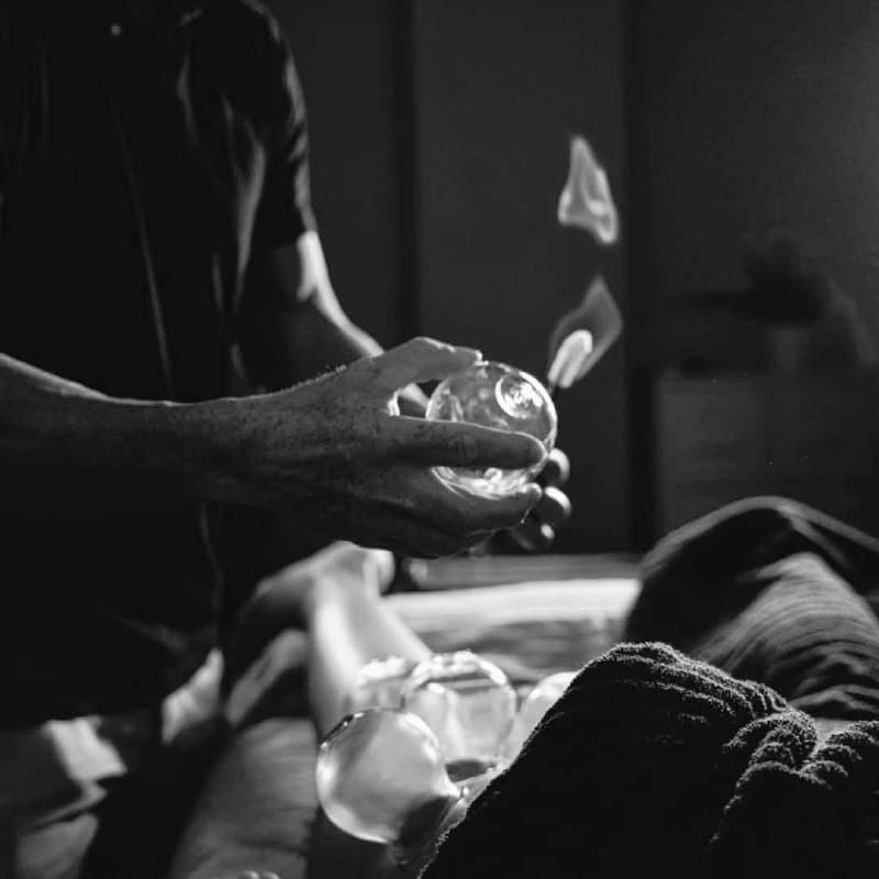 Technique de Décompression Myofasciale — ventouses sur le dos